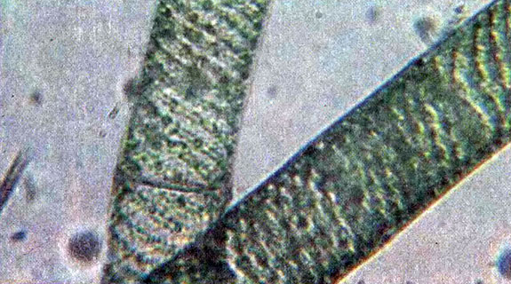 Спирогира - нитчатая водоросль со спиральным лентовидным хлоропластом