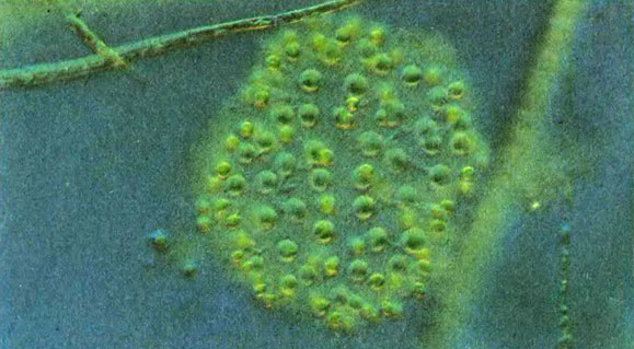 В планктоне Невы очень часто встречаются колонии диктиосфериума красивенького
