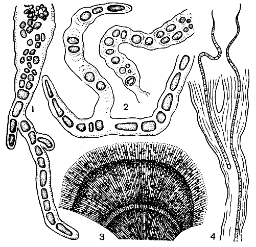 . 45.  (1, 2)   (3, 4) - : 1 -  (Hyella caespitosa),  ; 2 -  (Mastigocoleus testarum),  ; 3, 4 -  (Rivularia haematites) (3 -         ,   ,       ; 4 -     )
