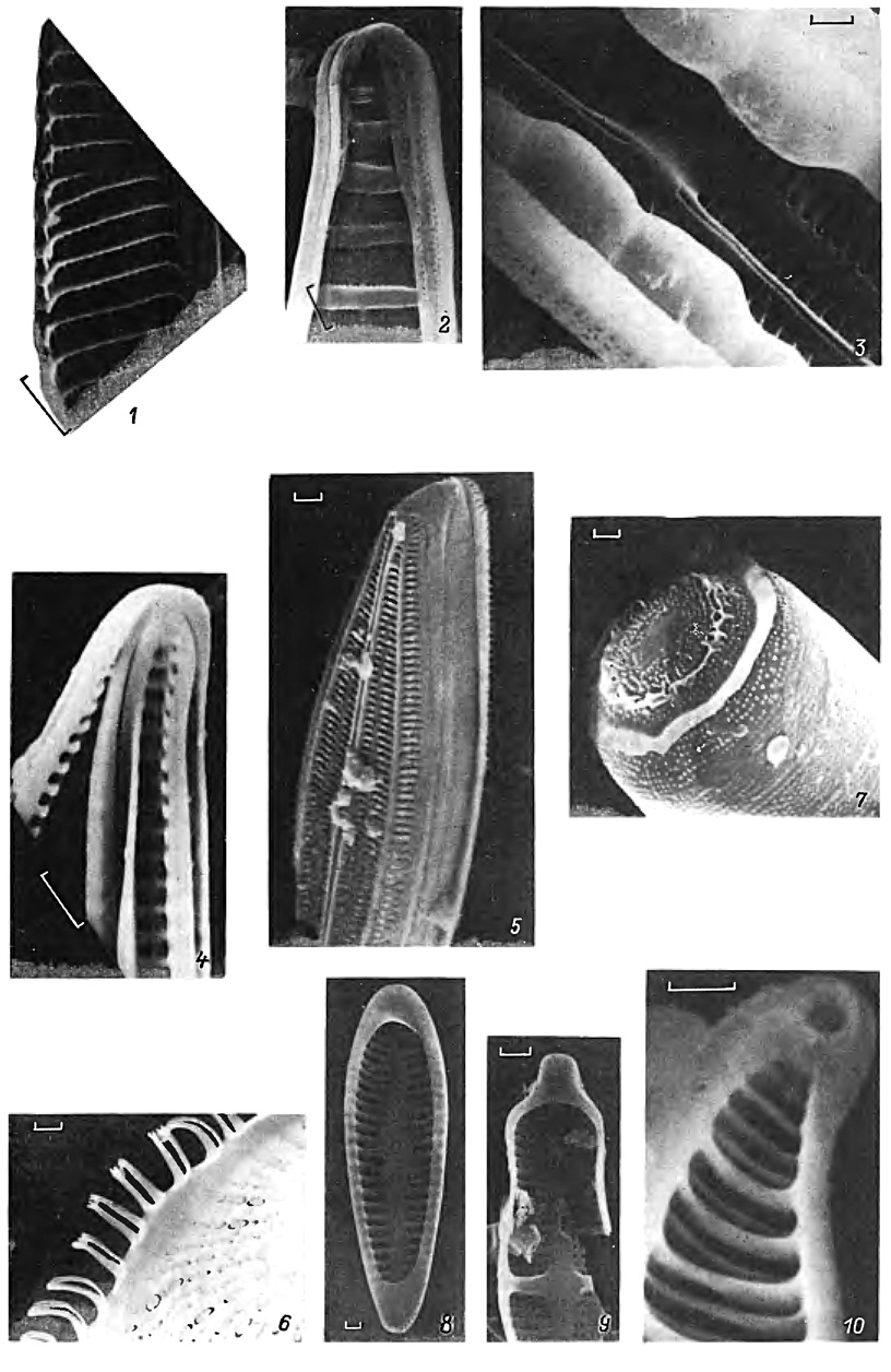  6. 1,2 -   (1 - Navicula sp., 2 - Diatoma hiemale (Lyngb.) Heib. var. mesodon (Ehr.) Grun.); 3, 4 -   (3 - Mastogloia pumila (Grun.) CI., 4 - Amphora securicula Perag.); 5 -         (Brachysira aponina Kutz.); 6, 7 -   (6 - Ditylum brightwellii (West) Grun., 7 - Melosira nummuloides (Dillw.) Ag.); 8-10 -    (8 - Rhoicosphenia curvata (Kutz.) Grun., 9 - Stauroneis smithii Grun., 10 - Rhopalodia gibba (Ehr.) O. Mull. var. ventricosa (Ehr.) Grun.). (; : 1 ; 1, 3,5, 7,10 - . . . , 2, 9 - . . . , 4 - , 1987, 6 - . . . , 8 - . . . )