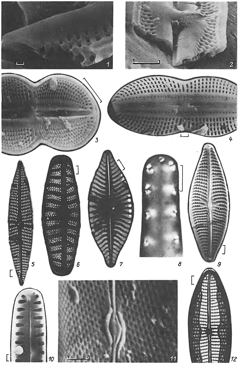  10. 1-4 -   (Diploneis didyma (Ehr.) Cl.): 1-2 -  , 3 -  ,    , 4 -   (      ); 5-11 - : 5 - , -    (Navicuh lanceolata (Ag.) KUtz.), 6 - ,       (N. pupula Kutz.), 7 -  (Achnanthes delicqtula Kiitz.), 8 -        (Thalassionema nitzschioides Grun.), 9 - ,   ,       (Navicula cryptocephala var. intermedia Grun.), 10 - ,      (Pinnularia borealis Ehr.), 11 -     (Pleurosigma elongatum W. Sm.); 12 -   (Mastogloia pusilla Grun.). (1-4, 9-11 - , 5-8, 12 - ; : 1, 4-10, 12 - 1 , 2, 3, 11 - 10 ; 1-7,10-12 - . . . , 8 - . . . , 9 - . . . )