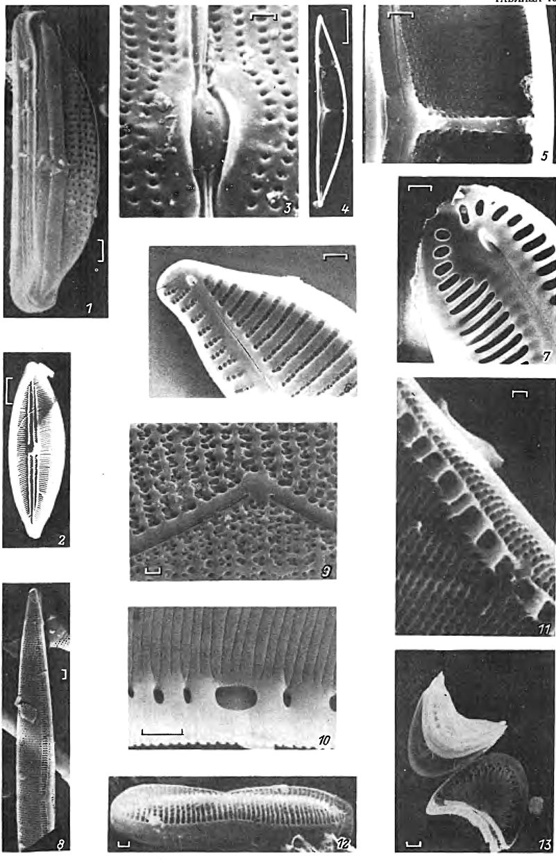  18. 1-11 -    : 1 -    (Amphora aff. A. acutiuscula Kutz.), 2, 3,-  ,   (2 - Mastogloia braunii Grun., 3 - Gyrosigma attenuatum (Kutz.) Rabh.),4, 5 -  (Amphora ostrearia Bieb.), 6 -  ,    (Cymbella minuta Hilse), 7 -  (Pinnularia sp.),8, 9 -      (8 - Nitzschia vidovichii (Grun.) Perag., 9 - Epithemia turgida (Ehr.) Kutz.), 10,11 -  ,  , (10 - Hantzschia amphioxys (Ehr.) Grun., 11 -Nitzschia obtusa W. Sm. var.scalpelliformis Grun.)j 12, 13 -   : 12 - ,   (Nitzschia sp.), 13 - ,   (Campylodiscus noricus Ehr. var. hibemicus (Ehr.) Grun.). (; : 1-3, 5, 6-12 - 1 , 4, 13 - 10 ; 1-3, 10-12 - . . . , 4, 5 - . . . , 6. 7, 13 - . . . , 8 - . . . , 9 - . . . )