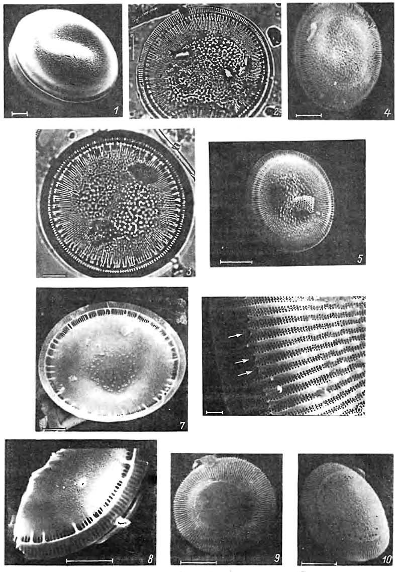  19. 1-8 - Cyclotella baicalensis Skv. f. baicalensis: 1 - , 2, 3 -  , 4, 5 -   , 6 -              (), 7 -   , 8 -    . 1 - . , 2-8 - -, . ; 9, 10 - C. corona Mukhina:   .  ,  . (1, 4-10 - , 2, 3 - ; : 1-10 - 10 ; 1 - . . . , 2-8 - . . . , 9, 10 - , , 1978)