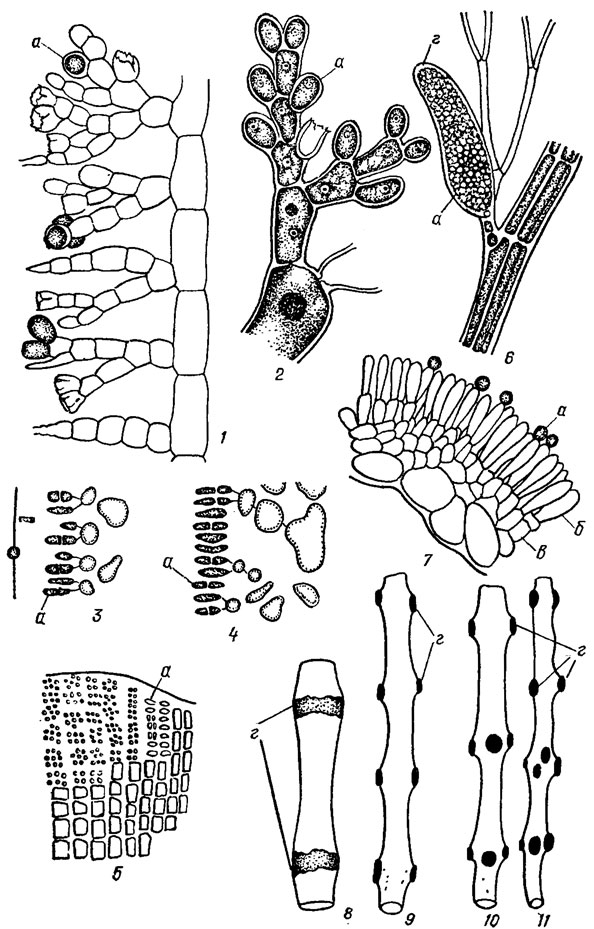 . 17.18.  ()  : 1 -   Batrachospermum orthostichum; 2 -   Nemalion multifidum (Web. et Mohr) Ag.; 3, 4 -  Gelidium sp.   ; 5 -  Peyssonnelia sp.; 6 -   Poiysiahonia sp.; 7 -  Lemanea catenate Kutz.   ; 8 -    Lemanea grand is (Wolie) Atkinson; 9-11 -    Lemanea mamlllosa (Sirod.) De Toni. a - ;  -  ;  -  ,  - 