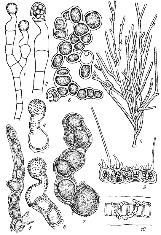 . 19.23. Ulotrichales:  Trentepohliaceae (1-7), Microthamniaceae (8), Aphanochaetaceae (9, 10): 1, 2 - Tretitepohlia uncinata (Gobi) Hansg. (1 -     , 2 -   ); 3-5 - Trentepohlia jolithus (L.) Wallr. (3 -  , 4, 5 -     ); 6, 7 - Trentepohlia umbrina (Kutz.) Born. (6 -   , 7 -     ); 8 - Microthamnion strictissimum Rabench.; 9 - Aphanochaete polychaete (Hansg.) Fritsch; 10 - Aphanochaete vermiculofdes Wolle