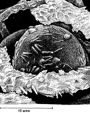 Рис. 12. Водорослевая клетка и грибные гифы слоевища платизматии сизой с кристаллами каператовой кислоты
