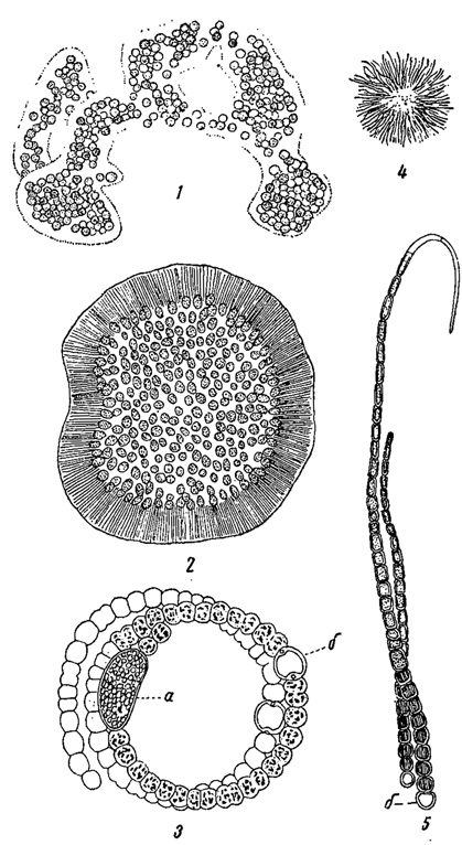 . 76. ,  -   ' '. 1 - Microcystis aeruginosa. 2 - Woronichinia Naegeliana. 3 - Anabaena flos-aquae. 4, 5 - Gloeotrichia echinulata: 4 -    , 5 -       ,  - ;  -  ( )